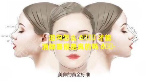泪沟怎么 🕊 才能消除喜报是真的吗 🌷